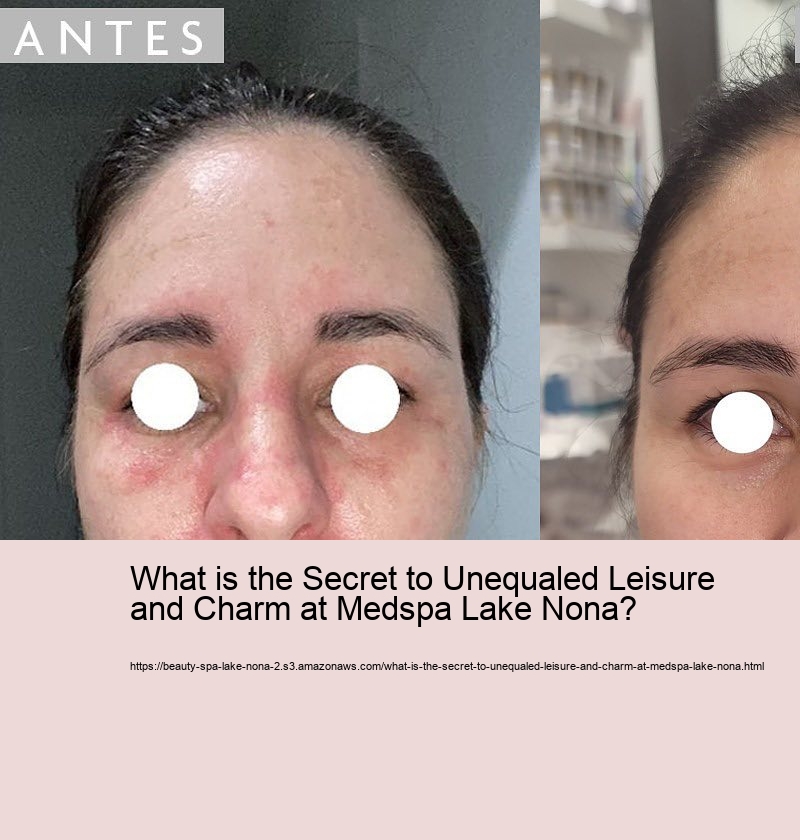 What is the Secret to Unequaled Leisure and Charm at Medspa Lake Nona?