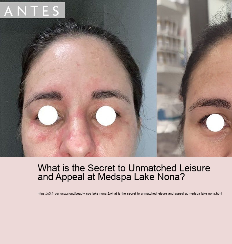 What is the Secret to Unmatched Leisure and Appeal at Medspa Lake Nona?